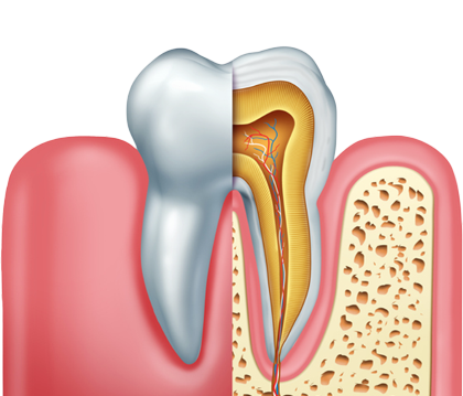 신경치료, 치아를 살리기 위한 치료